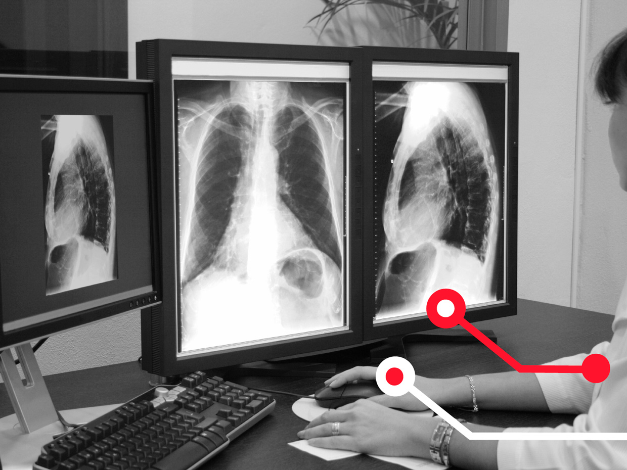 Radiologist reviewing chest X-rays on three monitors
